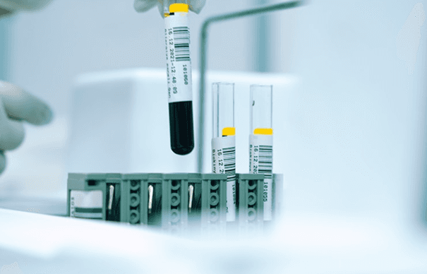Laboratory Testing